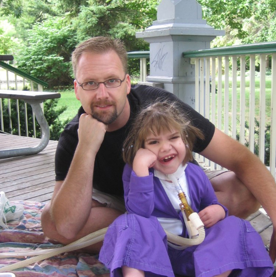 Father and Daughter posing the same. Daughter wearing trachestomy