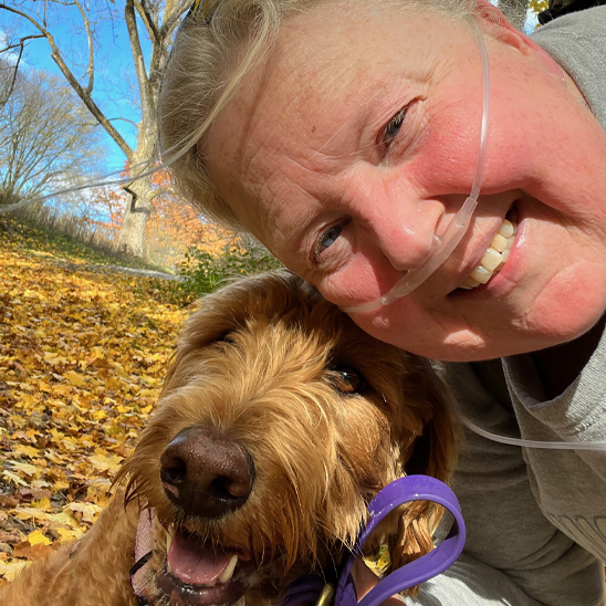 Monica in the park with her dog wearing nasal cannula
